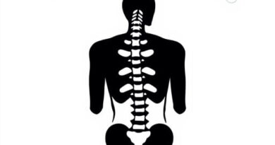 Mithridates VI Eupator Death