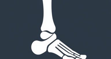 Bipartite Medial Hallux Sesamoid