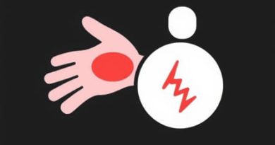 High Level Of Rheumatoid Factor