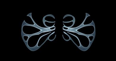 Annulus Fibrosus Calcification X Ray