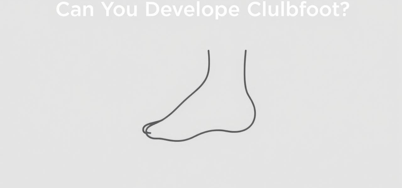 Can You Develop Clubfoot
