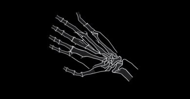 Fracture Of Ulnar Styloid Process