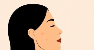 Fungal Acne Vs Hormonal Acne