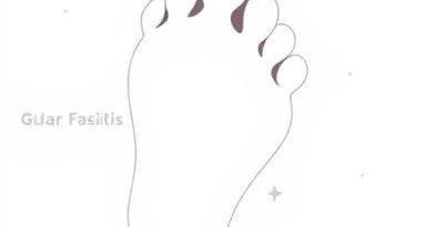 Gua Sha For Plantar Fasciitis