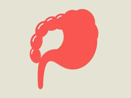 How Does A Hemorrhoid Look Like