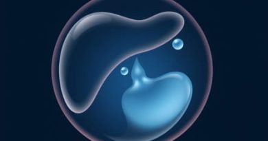 Minimal Free Fluid In Peritoneal Cavity