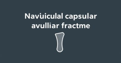 Navicular Capsular Avulsion Fracture