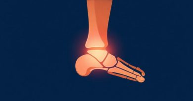 Nondisplaced Medial Malleolus Fracture