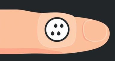 Random Blister On Finger