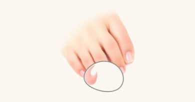 Toenail Reconstruction Near Me