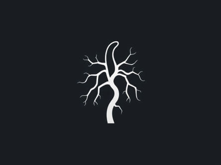 Vein Of Galen Malformation Icd 10