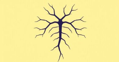Vein Of Galen Malformation Symptoms