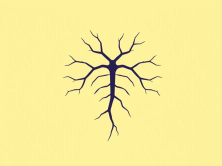 Vein Of Galen Malformation Symptoms