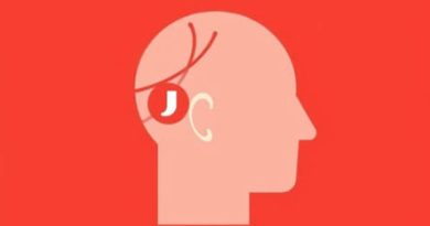 Vein On Left Side Of Head Throbbing