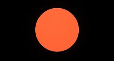 What Is Dimness Of Vision