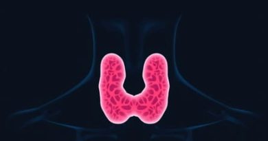 What Is Follicular Neoplasm Of Thyroid