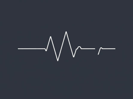 What Is The Function Of Cardiograph