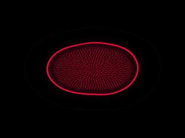 Lining Epithelium Of Seminal Vesicle