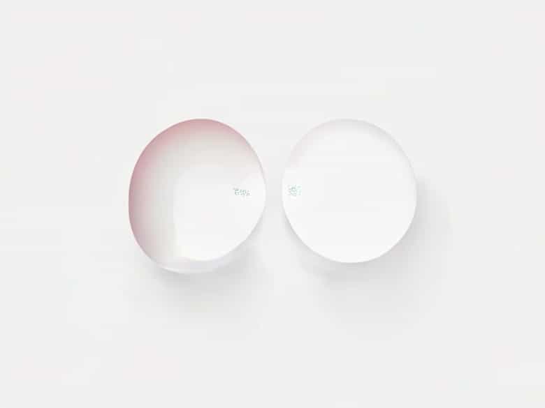 Difference Between Interproximal Space And Embrasure