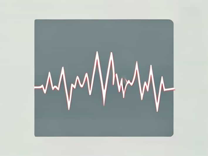 How Does An Abnormal Ekg Look Like