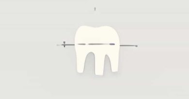 How Long Does A Mastectomy Take