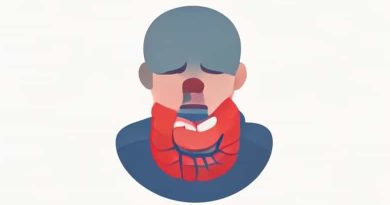 Lump In Throat After Esophageal Dilation