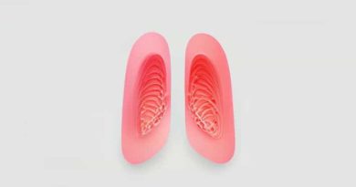 Mild Mucosal Thickening In The Maxillary Sinuses