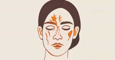 Best Treatment For Seborrheic Dermatitis On Face