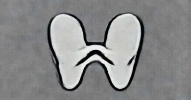 Bilateral Maxillary Sinusitis Meaning In Bengali