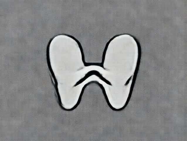 Bilateral Maxillary Sinusitis Meaning In Bengali