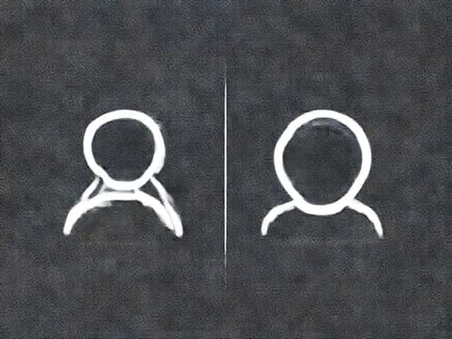 Difference Between Agoraphobia And Social Anxiety