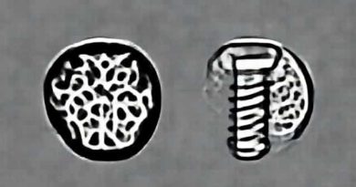 Difference Between Cortical And Cancellous Screw