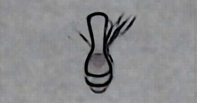 Differential Diagnosis Of Post Coital Bleeding