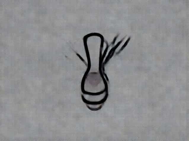 Differential Diagnosis Of Post Coital Bleeding