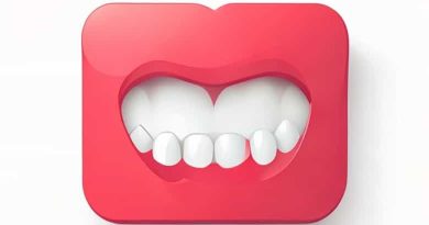 Excessive Protrusion Of The Maxillary Incisors