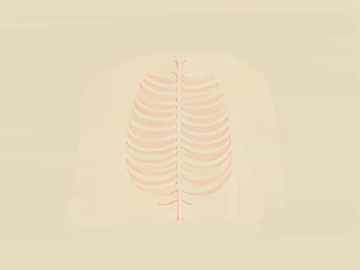 Mild Fatty Atrophy Of The Paraspinal Musculature