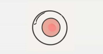 Open Subset Of Irreducible Space Is Irreducible