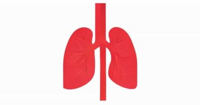 Partial Anomalous Pulmonary Venous Return Icd 10