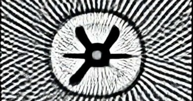 Unharmonious Anomalous Retinal Correspondence