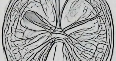 Xanthogranulomatous Cystitis Pathology Outlines
