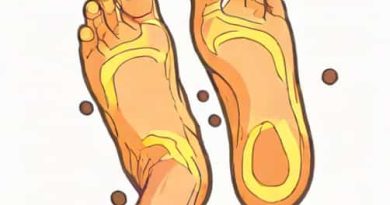 Blisters From Athlete'S Foot