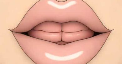 Cleft Lip Embryological Basis