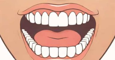 Jaw Atrophy After Tooth Loss