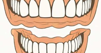 Margrethe Ii Of Denmark Teeth
