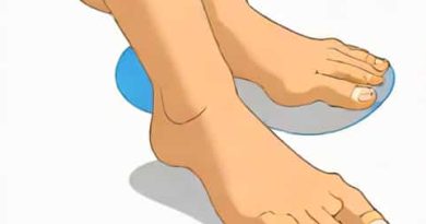 Orthotics For Forefoot Varus
