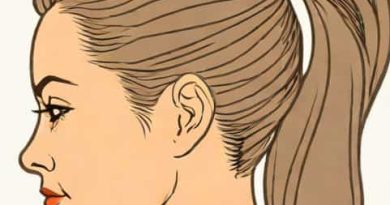 Reddit Hypothyroid Hair Loss