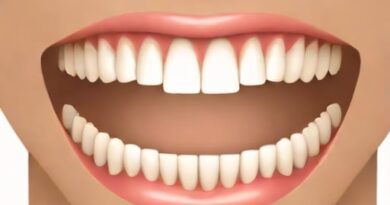 Nerve Supply Of Maxillary And Mandibular Teeth