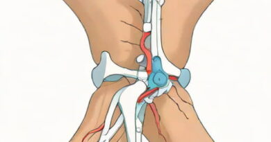 Ossification Of Anterior Longitudinal Ligament
