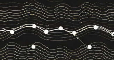 Ultrasound Waves Are Longitudinal Or Transverse
