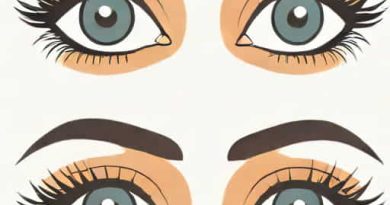 Eyes Looking In Different Directions